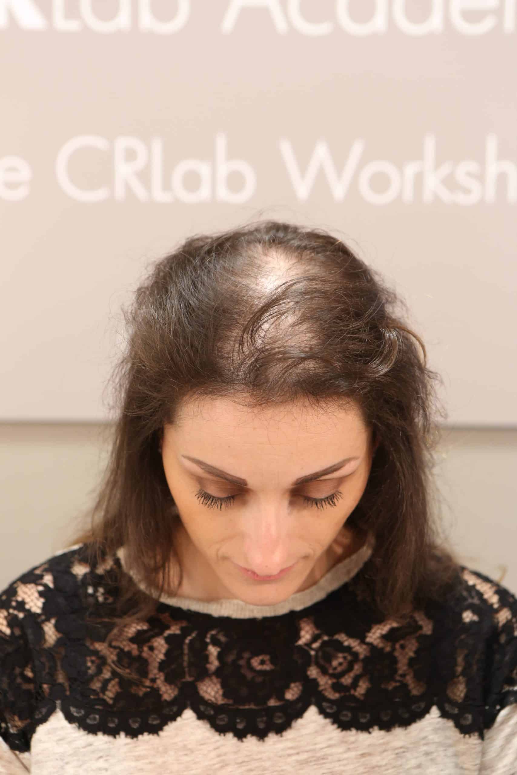 Woman has hair and scalp inspected by CRLab's scope
